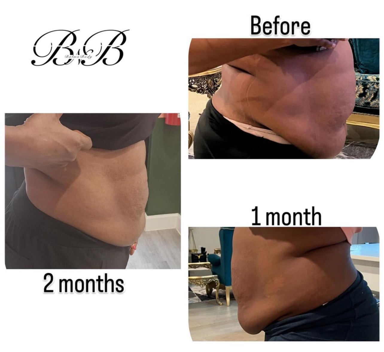 Body sculpting before and after progress results Sugar Land TX